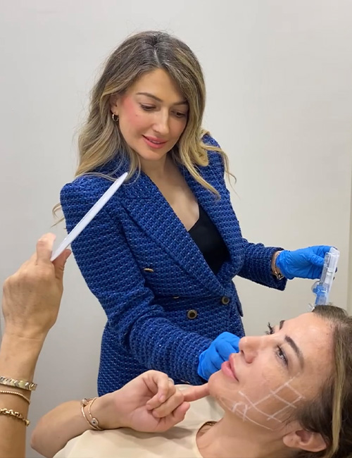 Sıvı Yüz Germe Radiesse, Harmonyca Ve Ellanse Uygulaması